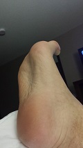 foot fetish photo