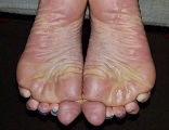 Foot Fetish Photo