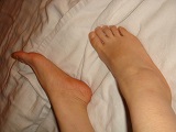 Foot Fetish Photo