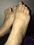 Foot Fetish Photo