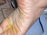 Foot Fetish Photo