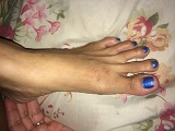 Foot Fetish Photo