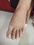 Foot Fetish Photo