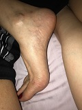 Foot Fetish Photo