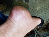 Foot Fetish Photo