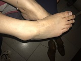 Foot Fetish Photo