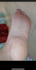 Foot Fetish Photo