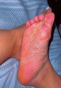 Foot Fetish Photo