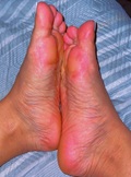 Foot Fetish Photo