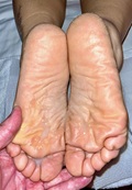 Foot Fetish Photo