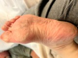 Foot Fetish Photo
