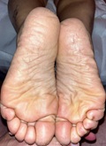 Foot Fetish Photo