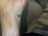 Foot Fetish Photo