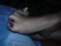 Foot Fetish Photo