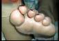 Foot Fetish Photo