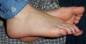 Foot Fetish Photo