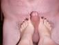foot fetish photo