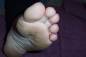 Foot Fetish Photo