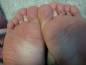 Free Foot Fetish Photo