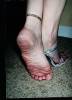 Foot Fetish Photo