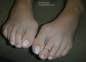 Foot Fetish Photo