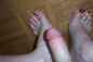 Foot Fetish Photo