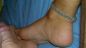 Foot Fetish Photo