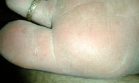 Free Foot Fetish Photo