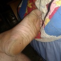 Foot Fetish Photo