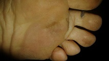 Foot Fetish Photo