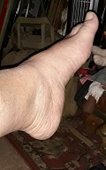 Foot Fetish Photo