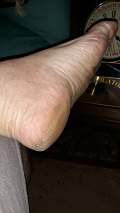 Foot Fetish Photo