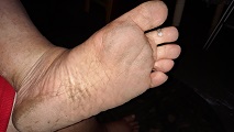 Foot Fetish Photo