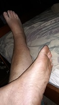 Foot Fetish Photo