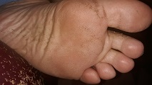 Foot Fetish Photo