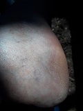 Foot Fetish Photo