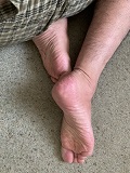 Foot Fetish Photo