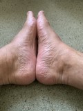 Foot Fetish Photo