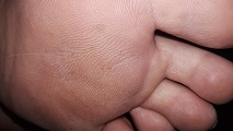 Foot Fetish Photo