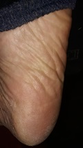 Foot Fetish Photo