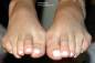 foot fetish photo