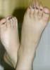 http://www.greatfeet.com/stories/ts1048/ts1048-20060712b01.jpg