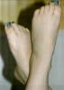 http://www.greatfeet.com/stories/ts1048/ts1048-20060712b02.jpg